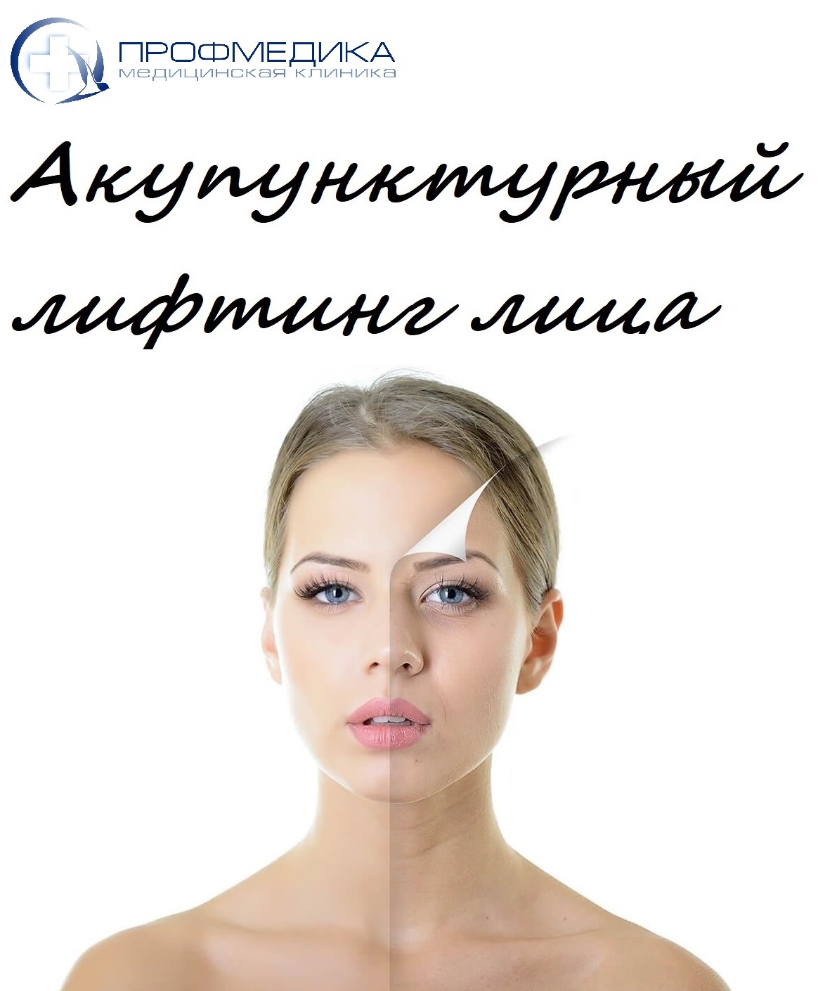 Акупунктурный лифтинг лица